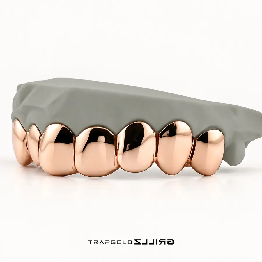 Rose Gold